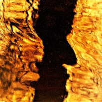 Beyond Normal Vision