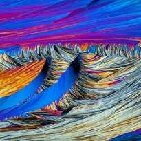 hippuric acid, microcrystals in polarized light.