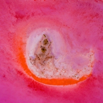 Embryo