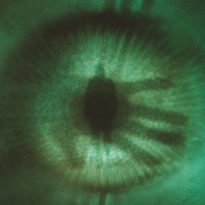 Eye
